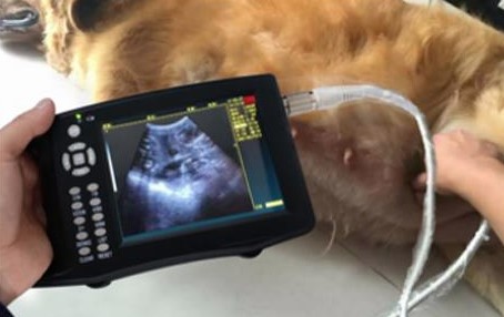 Ultrasonografi